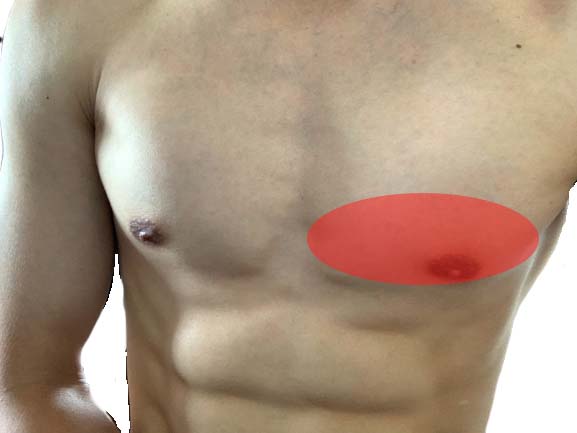 デクラインベンチプレスの角度や代用方法は やり方も解説 Fitmapマガジン
